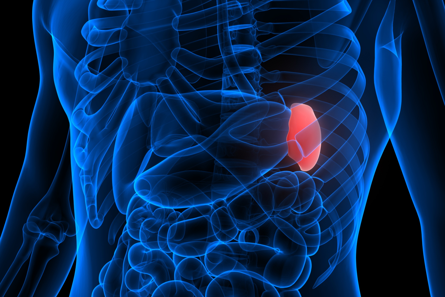 Spleen-xray-schematic-1500x_307427939.jpg